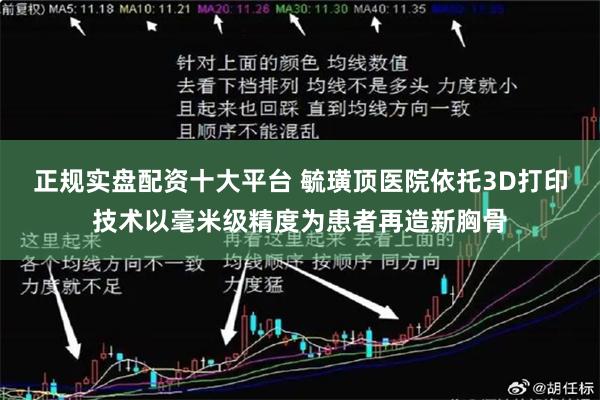 正规实盘配资十大平台 毓璜顶医院依托3D打印技术以毫米级精度为患者再造新胸骨